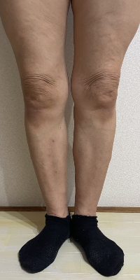 姿勢改善後の画像