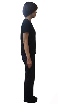 スウェイバック姿勢の画像