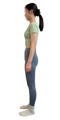 姿勢改善後の画像