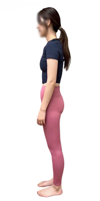 スウェイバック姿勢の写真